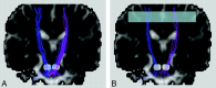 Fig 4.