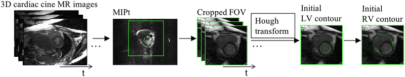 FIG. 1