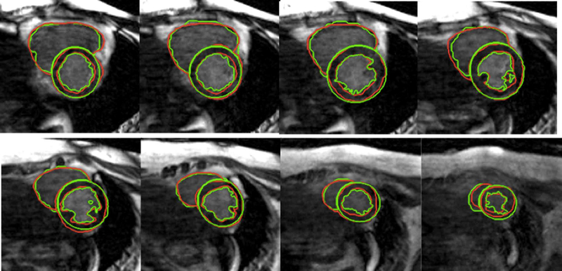 FIG. 5