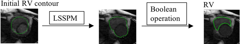 FIG. 3