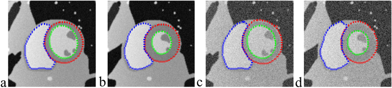 FIG. 4