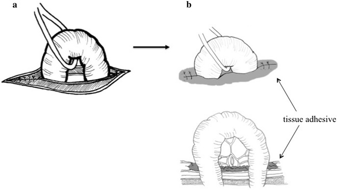 Fig. 1