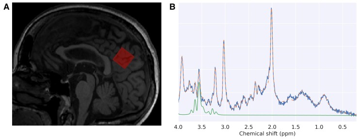 Figure 1