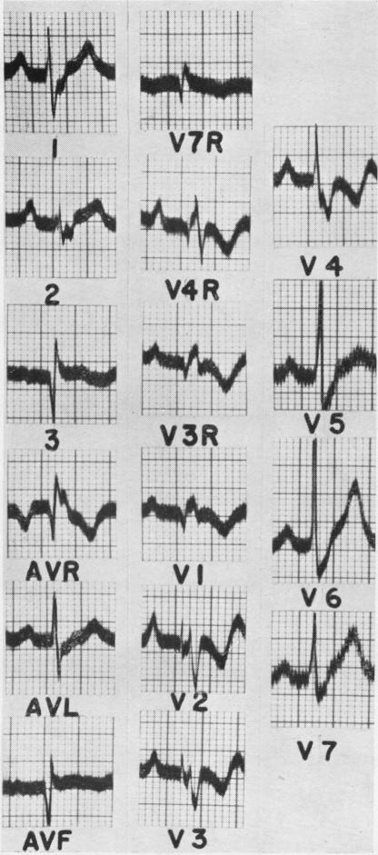 graphic file with name thorax00033-0026-a.jpg