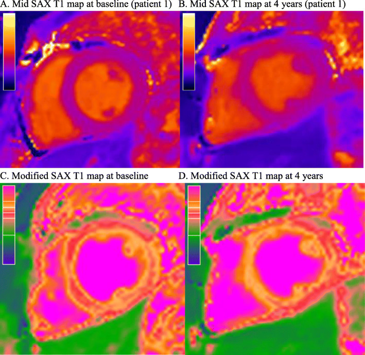 Fig. 2