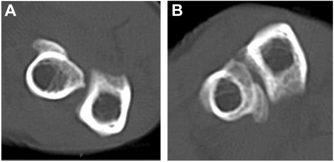 Figure 2