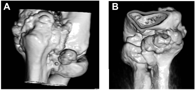 Figure 3