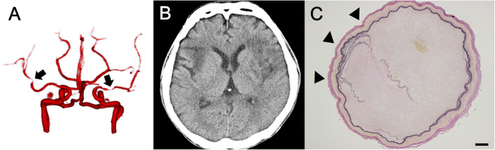 Fig. 3