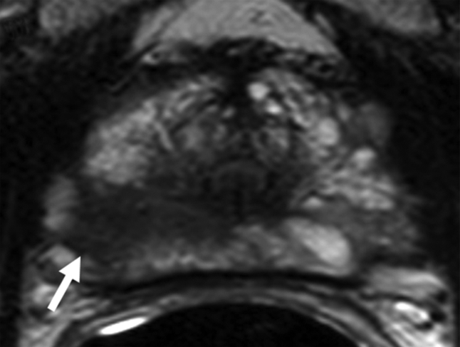 Figure 4a: