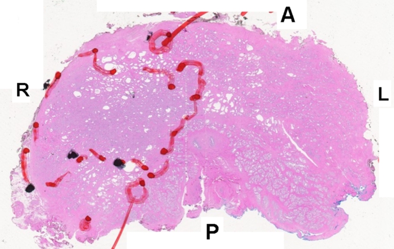 Figure 4e: