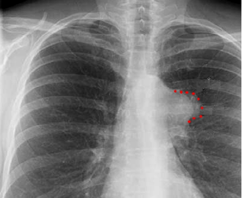Figure 3