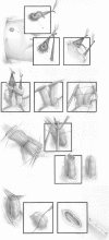 Fig. 5