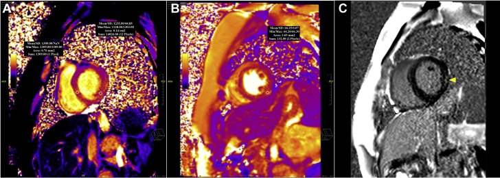 Figure 3