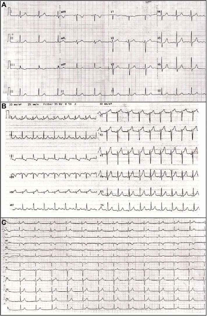 Figure 1