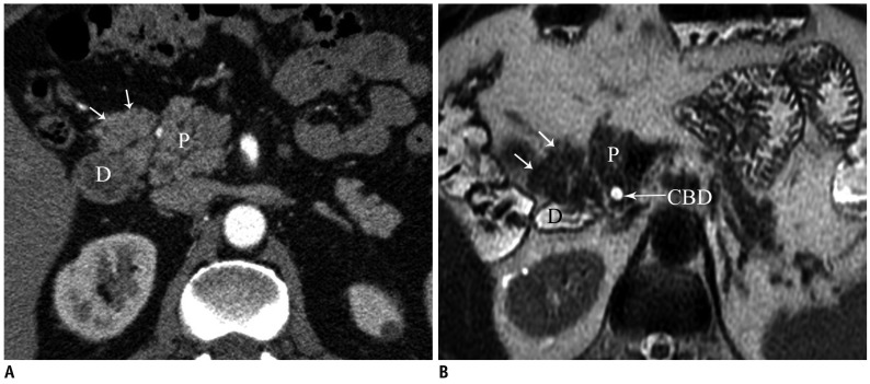 Fig. 16