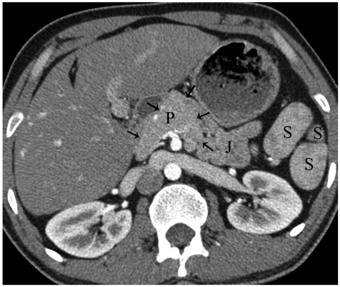 Fig. 14