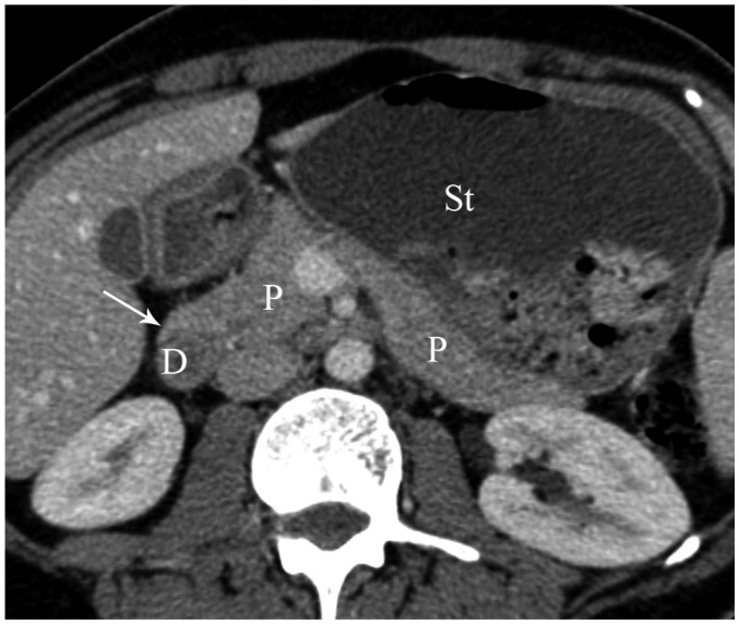 Fig. 13