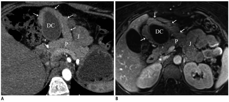 Fig. 15