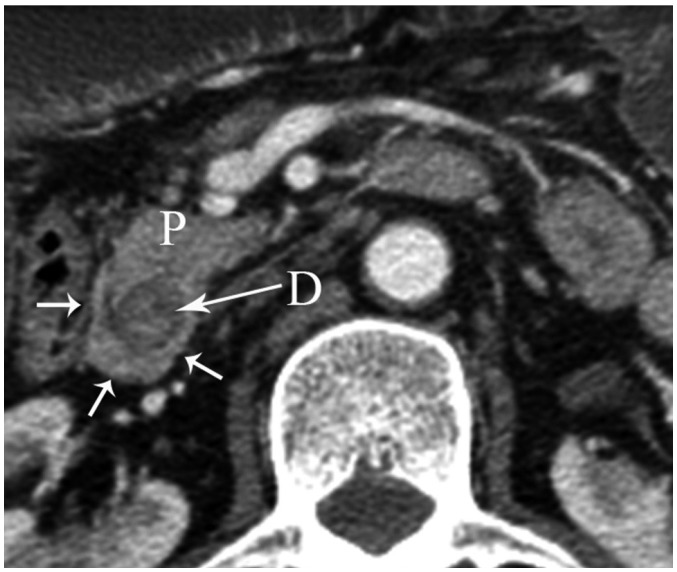 Fig. 12