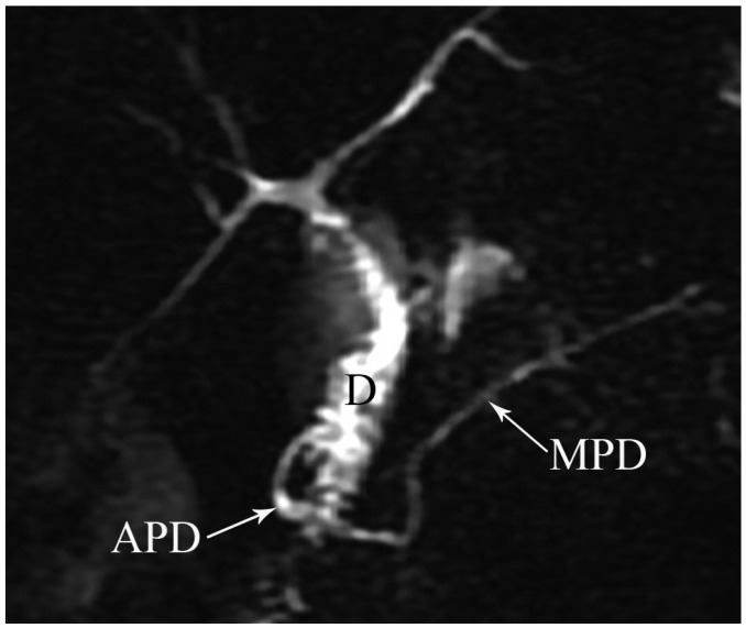 Fig. 11