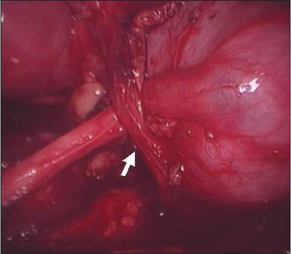 Figure 1b