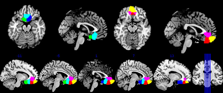 FIGURE 1