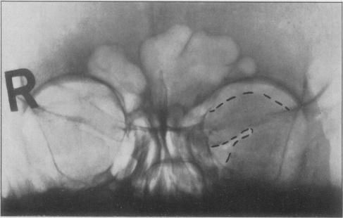 Fig. 12