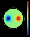 Fig. (2)
