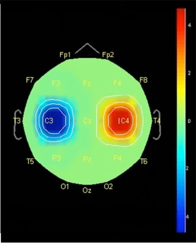 Fig. (2)