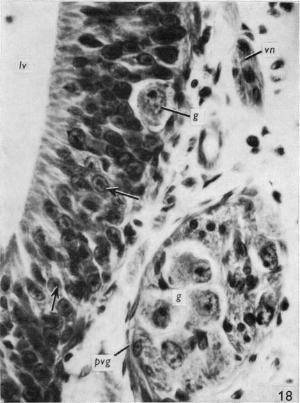 Fig. 18