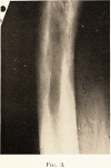 316-1
