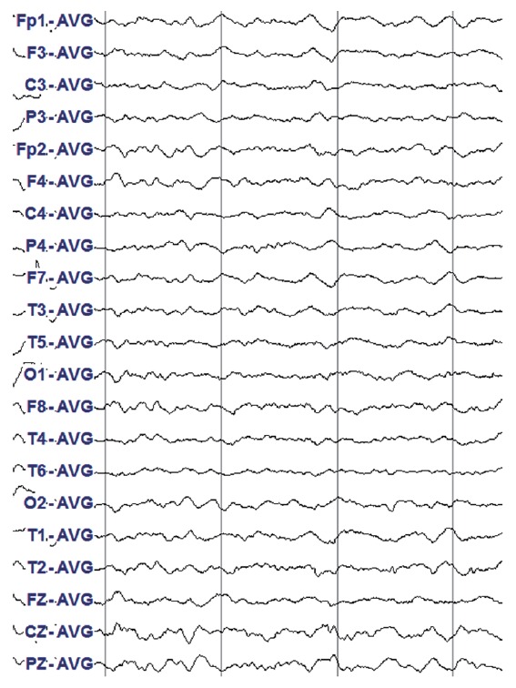 Figure 2.