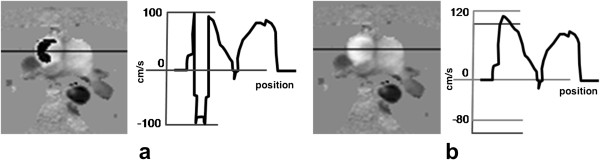 Figure 43