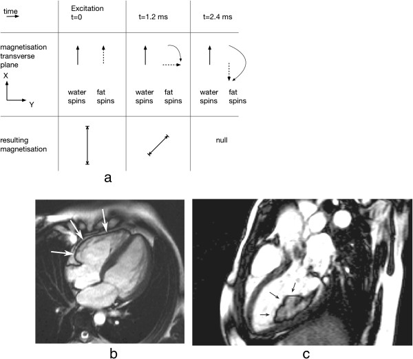 Figure 32