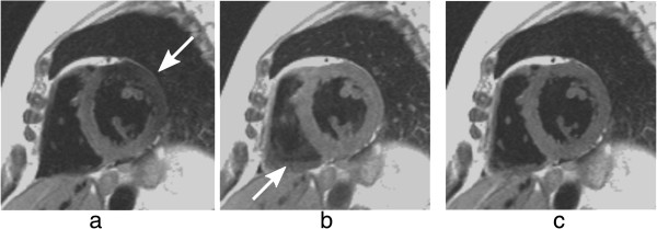 Figure 21