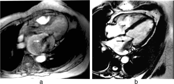 Figure 27