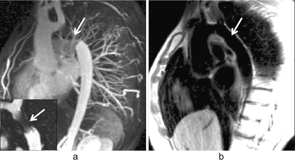 Figure 36