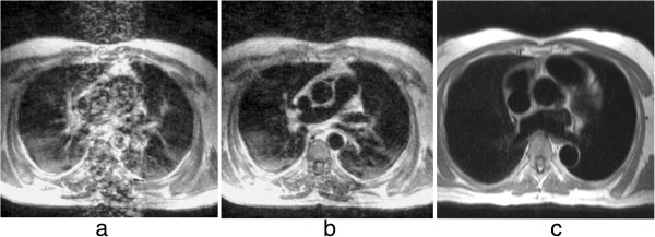 Figure 25