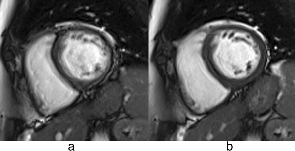 Figure 24