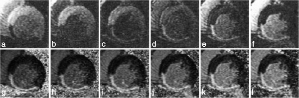 Figure 45