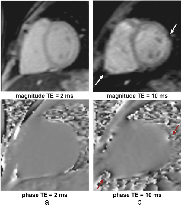 Figure 33