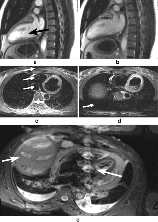 Figure 47