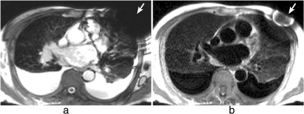 Figure 34