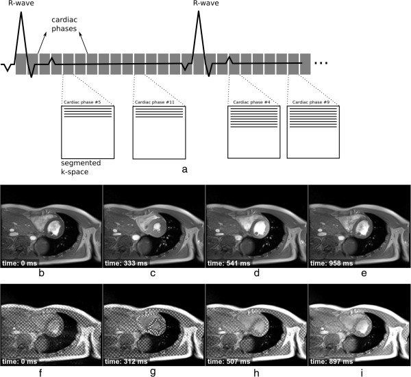 Figure 12