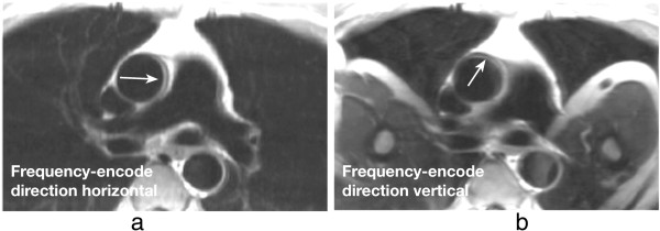 Figure 30