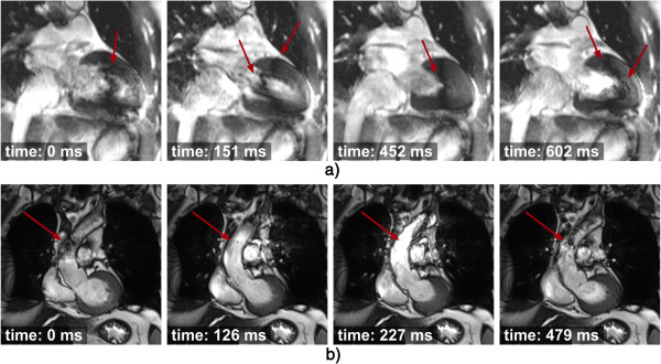 Figure 38