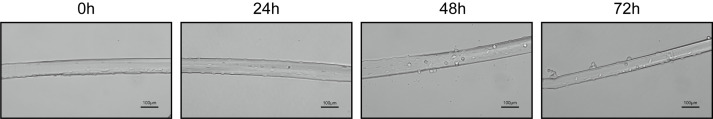 Isolation and Culture of Single Myofiber and Immunostaining of ...