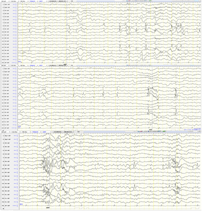 Fig. 2