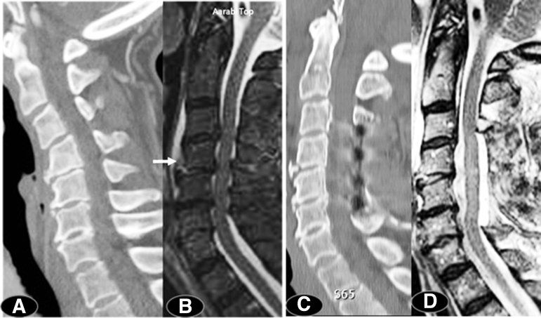 FIG. 3.