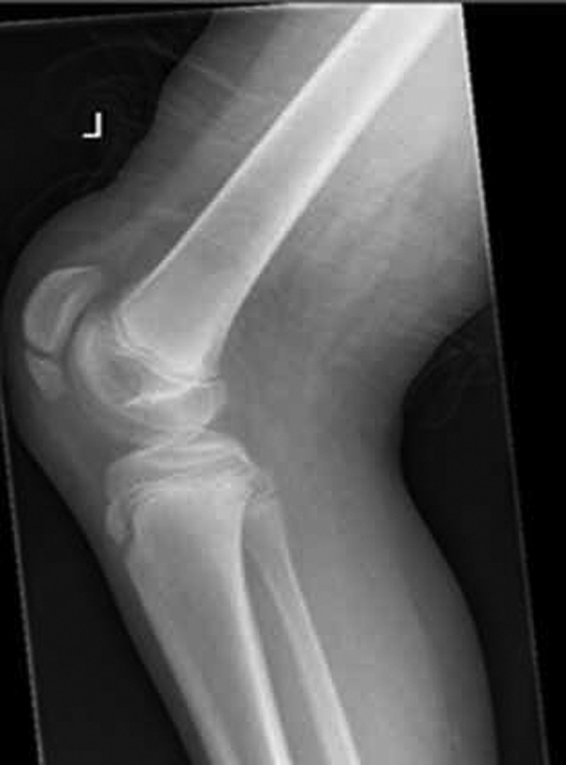 Figure 2